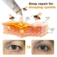 ALLILUYAA 2PCS Furzero Bee Venom Anti-Wrinkle Cream, Furzero Bee Venom Wrinkle Removal Cream, Anti-Wrinkle Moisturiser for Face and Neck, Bee Venom Anti-Wrinkle Cream for All Skin Types