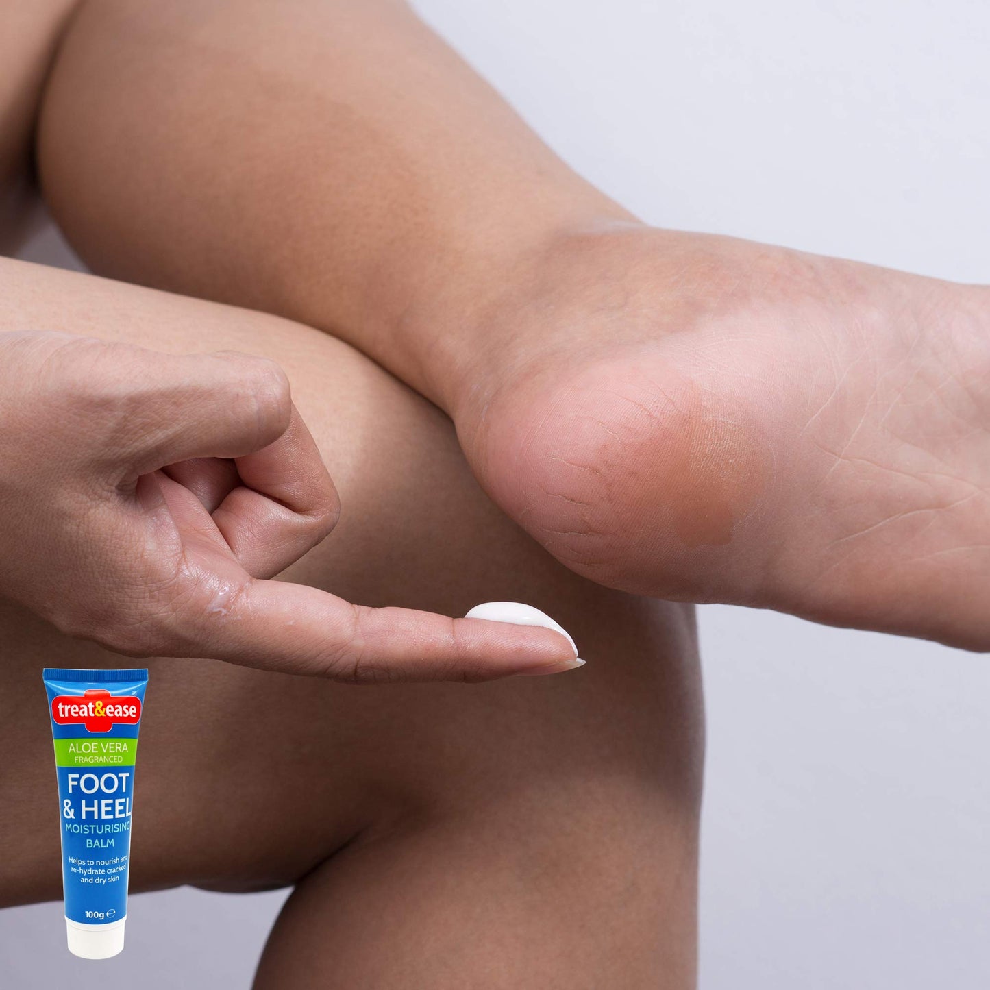 2pk Moisturising Foot Cream for Cracked Heels and Dry Skin | 200g | Dry Foot Cream for Very Dry Feet & Cracked Heel Repair Cream | Heel Balm for Cracked Heel Cream, Foot Balm Feet Cream + SOL Sticker