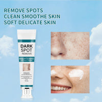 GNAUMORE Freckle Remover Cream,Dark Age Spot Remover,Spot Cream Dark Spot Corrector,Reduce Dark Spots & Soften Skin,Hyperpigmentation Treatment,20g