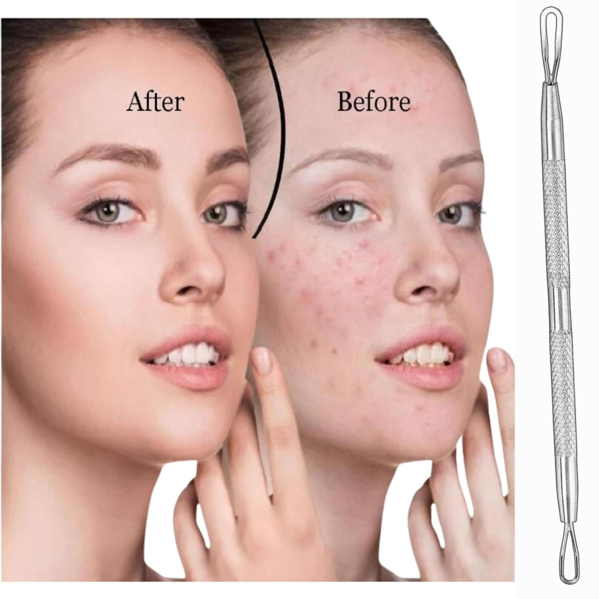 Glamified , glam Glamified Blackhead Remover Professional Skincare Spot Treatment Blackhead Remover Tool for Blemish Comedone Whiteheads Pimple Popper with Double Sided Soft Touch and Anti-Slip Design