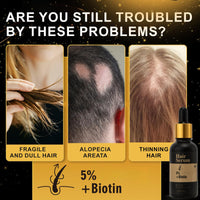5% + Biotin Hair Serum, 5% Hair Growth Serum For Men And Hair Regrowth Treatment For Stronger Thicker Longer Hair Help to Stop Thinning and Loss Hair 60 ML