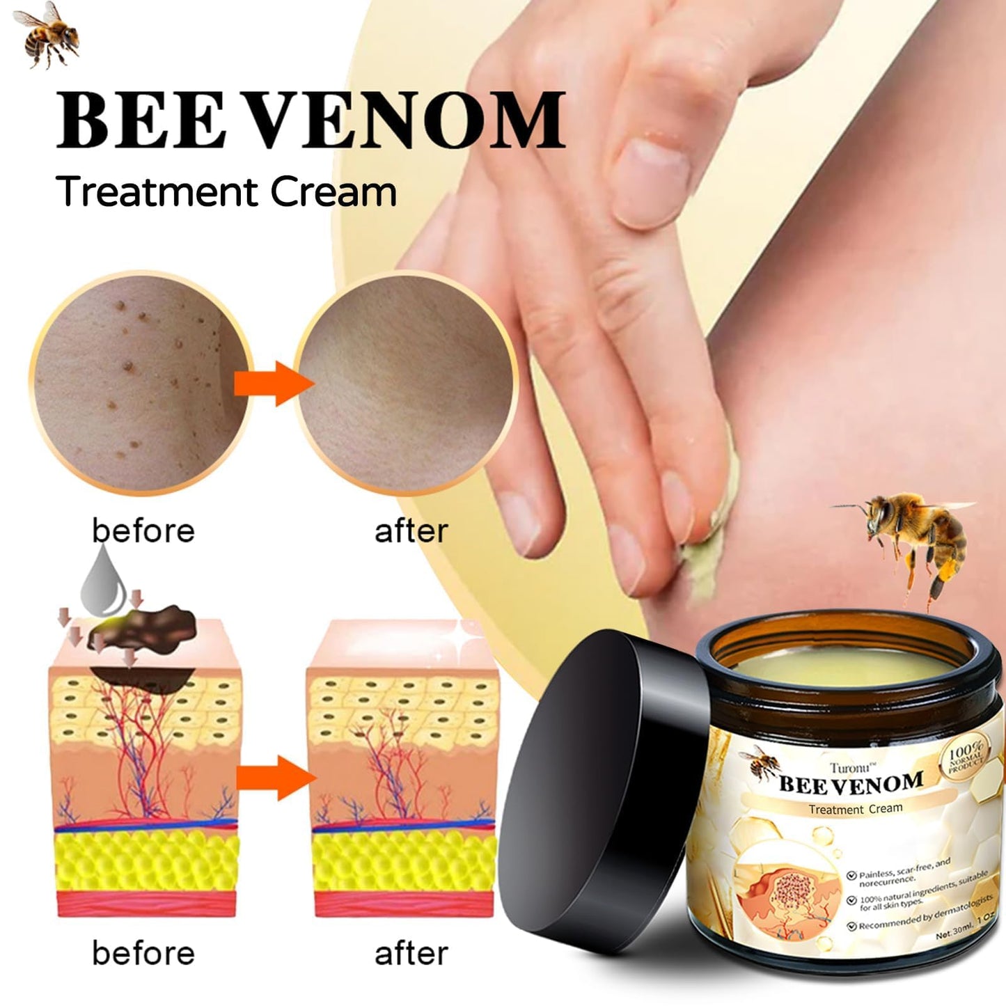 DEJIN 2 Pcs Bee Venom Skin Treatment Cream, Professional Repair and Moisturizing Gel, Hydrating New Formula for All Skin Types