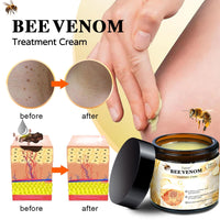 DEJIN 2 Pcs Bee Venom Skin Treatment Cream, Professional Repair and Moisturizing Gel, Hydrating New Formula for All Skin Types