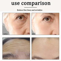 2PCS Bee Veno-m Face Creams for Skin Firming, Hydration & Moisturization - Soothing Moisturizer for Dry Skin