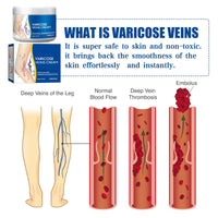 Boxiatil Leg Care Balm
