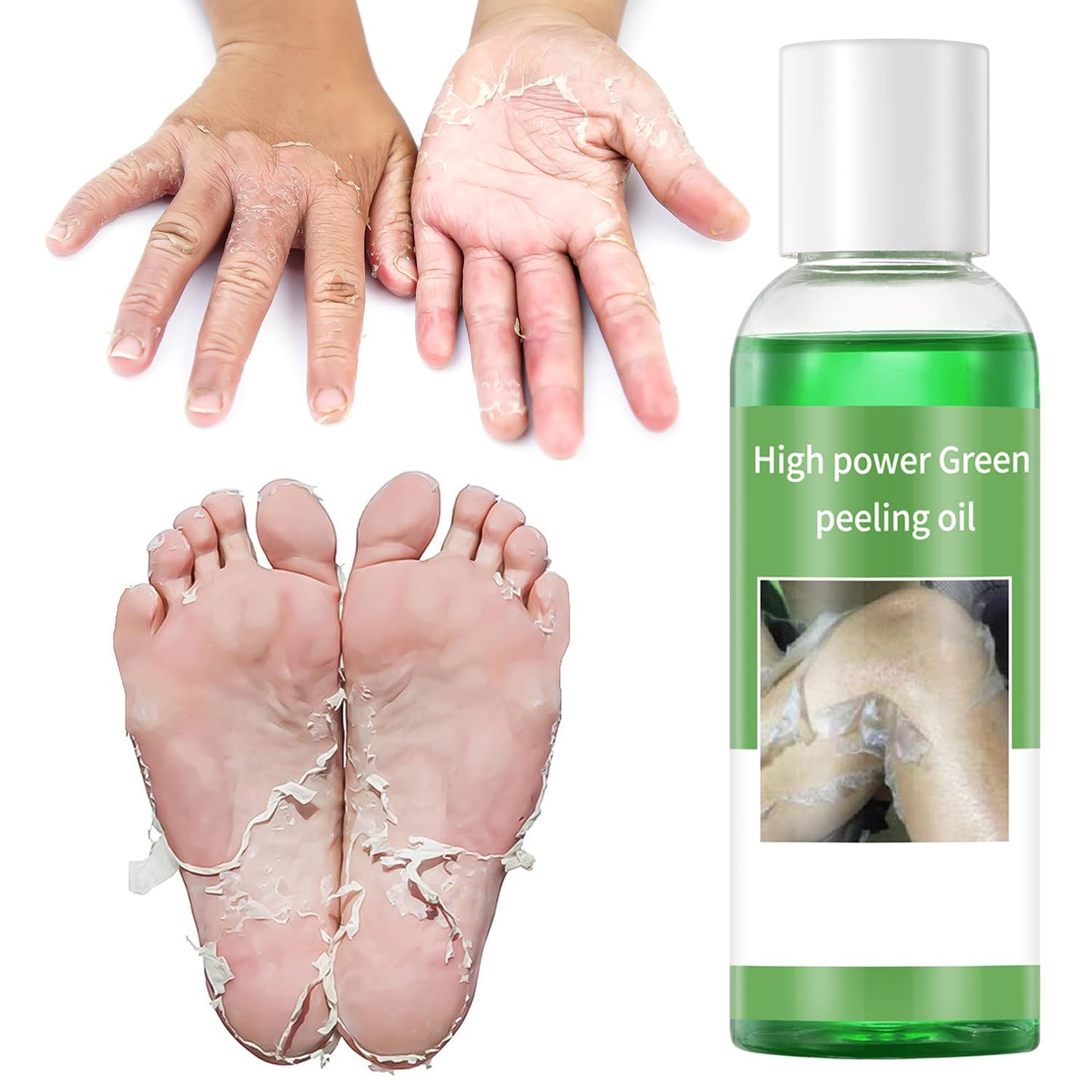 IREV Exfoliating Peeling Oil, Foot Peel Oil for Dry Dead Skin, Gentle Body Exfoliating for Women and Men