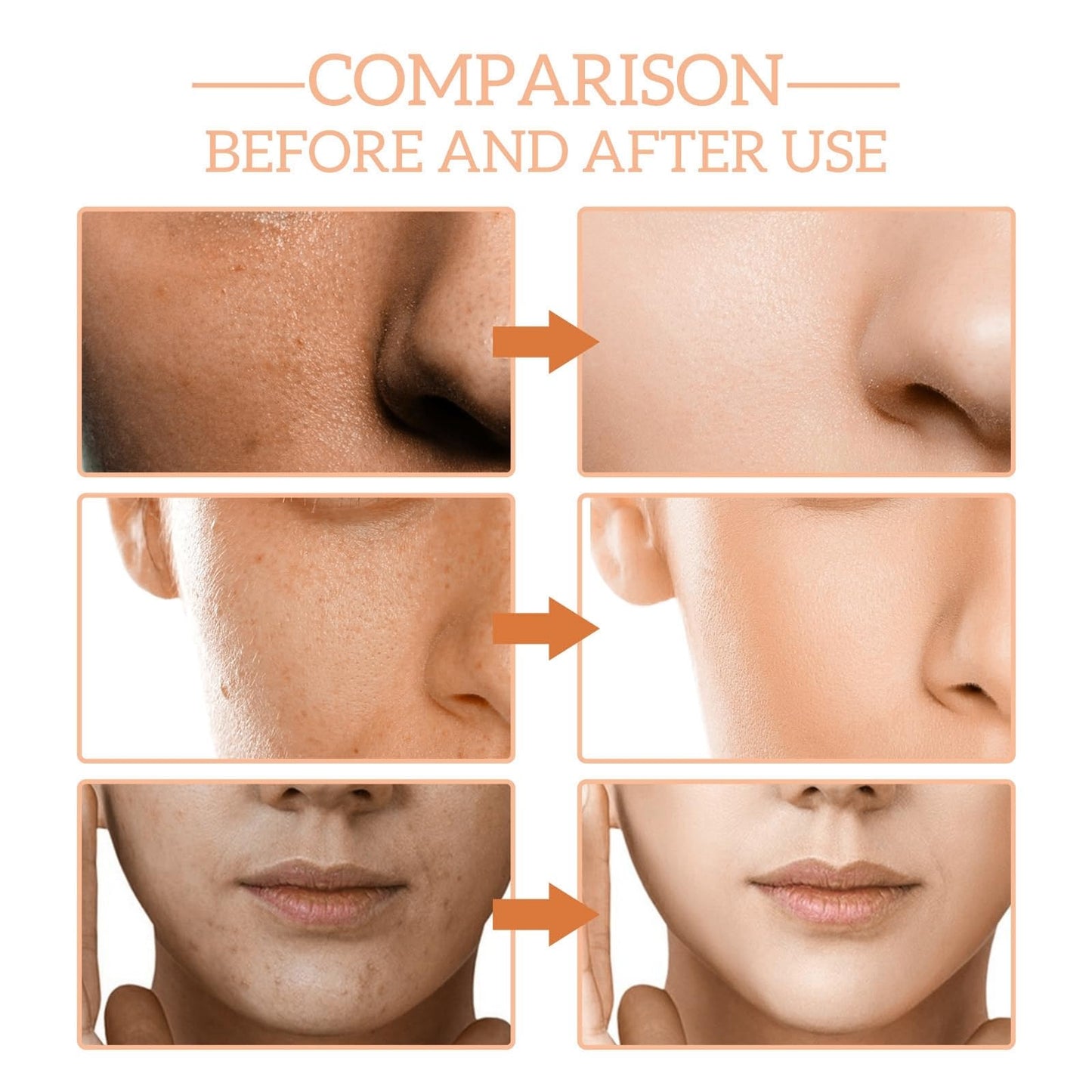 Organic Paracress Facial Oil,Paracress Facial O-il,Anti-Aging Paracr-ess Oi-l for Face,Para-cress Fac-ial Oi-l Ser-um,Parac-ress Anti Wrinkle Seru-m,Fac-e Seru-m,Moisturiser Fac-e,Anti Aging Serum