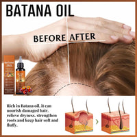 HERBENJOY Batana Oil For Hair Growth,Moisturizes Scalp & Hair Oil,Nourishing & Volumizing Hair GrowthOil,Pumpkin SeedOil For Hair Strengthening And Scalp Care,4-In-1 ScalpOil Veganic Wild HairGrowthOil