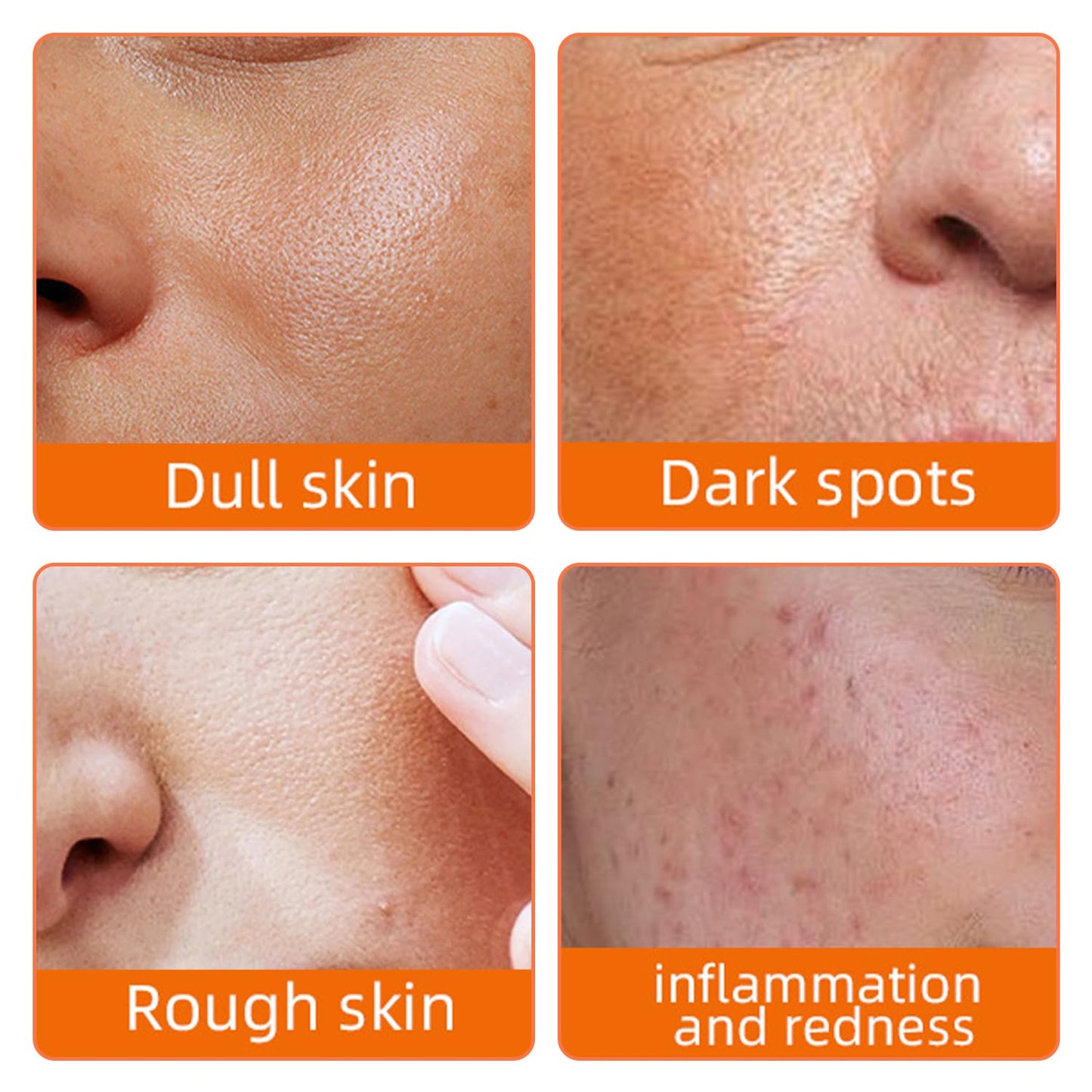 L0famy 50Pcs Turmeric Kojic Acid Pads, Exfoliating Face Cleansing Cotton Pads, Kojic Acid and Turmeric Pads, for Face, Body, Acne, Dark Spots, Hyperpigmentation, Smooth Skin