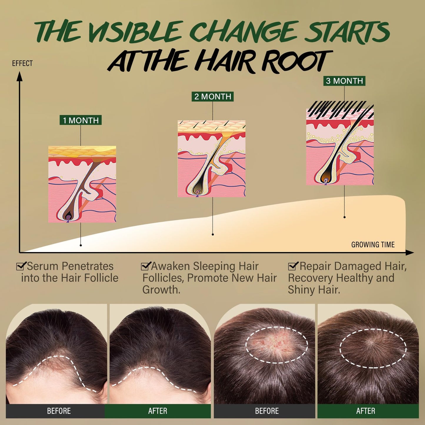 POP MODERN.C Rosemary & Biotin Hair Growth Kit, Rosemary Oil for Hair Growth witn Derma Roller & Scalp Massager Hair Thickening Products Hair Loss Treatment for men for Men Women, 30 ml Pack of 2