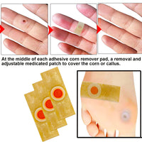Mcvcoyh Corn Removal 35 Pieces Corn Remover Pads Wart Remover Callus Cushions Treatment Relief Corn Pain and Foot Care