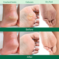PLANTIFIQUE Plantifique Foot Peel Mask Foot Mask Dermatologically Tested Repair Heels & Removes Dry Dead Skin for Soft Baby Feet - Exfoliating Peel Mask for Hard Skin Peeling (Aloe Vera 2 Pack)