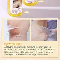 Yellow Peeling Oil - Lightening Exfoliating Dark Skin For Body, Strong Peeling Oil, Skin Peeling Oil For Skin Lightening, Peeling Oil For Skin Brightening Moisturizing, Peeling Solution Dark Skin