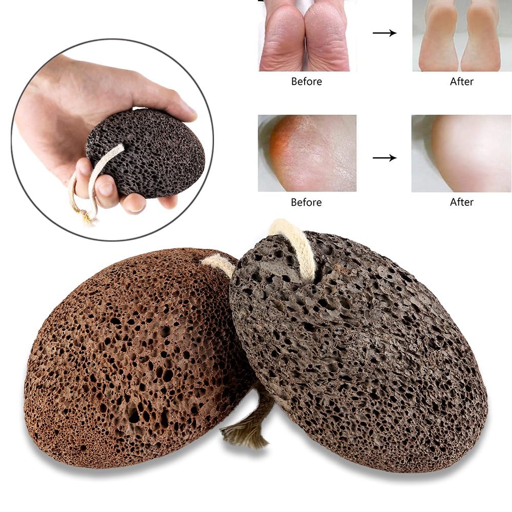 PHOGARY Natural Pumice Stone for Feet, 1 Pack Volcanic Lava Foot Stone Pedicure Tools Hard Skin Callus Remover for Feet and Hands - Natural Foot File Exfoliation to Remove Dead Skin-Black Foot Pumice