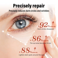 Eye Radiance Restoring Retinol Eye Cream Balm,Anti Wrinkle E-ye Cream Balm,Caffeine E-ye Creams for Dark Circles and Puffy Eyes,Korean Skincare Hydrating E-ye Creams for Dry Skin Around Eyes