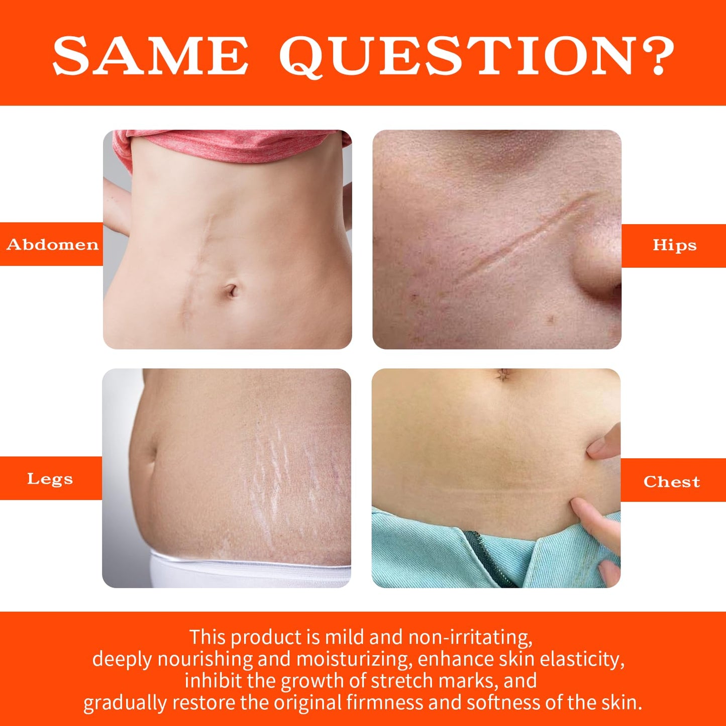 PlusBee Bio Oil Scar Treatment, Collagen Boosting Oil for Scars, Stretch Marks & Uneven Skin Tone, Skincare Serum for Pregnancy, Acne & Surgery Scars, 125ml