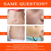 PlusBee Bio Oil Scar Treatment, Collagen Boosting Oil for Scars, Stretch Marks & Uneven Skin Tone, Skincare Serum for Pregnancy, Acne & Surgery Scars, 125ml