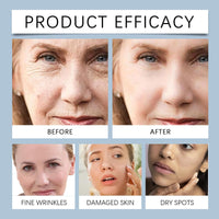2PCS Liquid Solution Serum&Intense Eye Cream,Ola/vita Serum & Intense Eye Revive Cream,Liquid Wrinkle Remove Serum & Eye Cream,Ola/vitas Solution