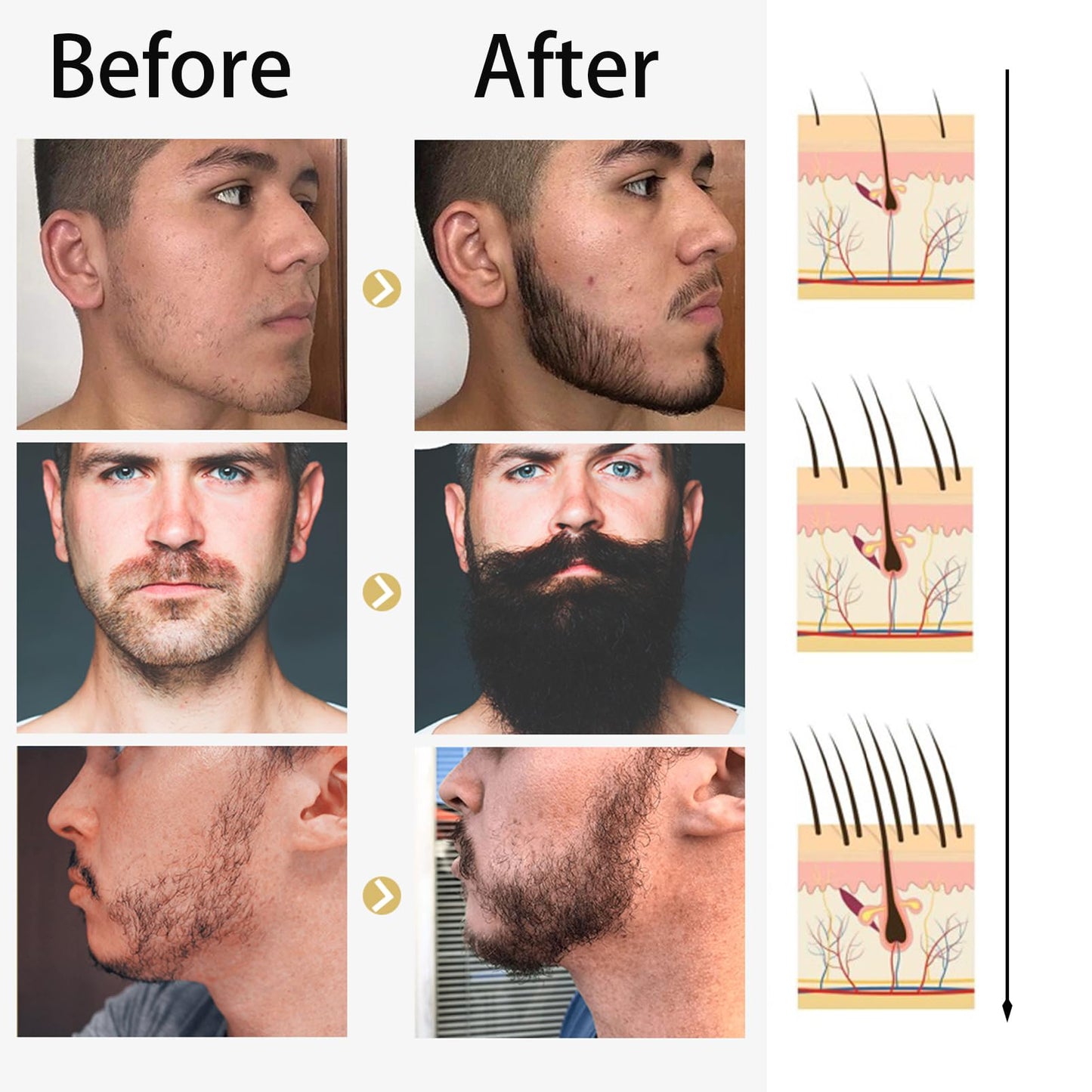 Beard Growth Kit,Beard Oil Beard Growth Serum for Men,0.5MM Derma Roller for Beard Growth,Beard Grooming Tools for Beard Rapid Growth and Thickening