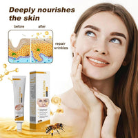 ALLILUYAA 2PCS Furzero Bee Venom Anti-Wrinkle Cream, Furzero Bee Venom Wrinkle Removal Cream, Anti-Wrinkle Moisturiser for Face and Neck, Bee Venom Anti-Wrinkle Cream for All Skin Types