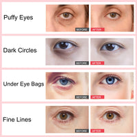 Generic Retinol Eye Stick, Eye Cream For Dark Circles And Eye Puffiness, Hydrates, Firms, Brightens, Fine Lines, For All Skin Types 3G (Retinol)