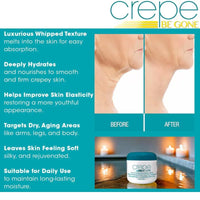 AHVKNU Crepe Be Gone Body Souffle-3oz Firming Neck Cream,Ultra Hydrating Crepe Skin Firming Cream for Chest, Arms & Legs, Skincare Cream Deep Hydration,Suitable for all skin Crepe Eraser for Women.