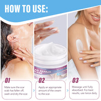 mysemgshuo 50g Advanced Scar Gel Cream, Scar Repair Cream, Scar Removal,Scar Treatment, Scar Removal Cream for C-Section, Stretch Marks, Acne, Effective for Both Old and New Scars