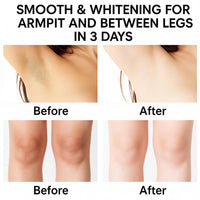 Generic Brightening Cream for Underarm & Body – with Kojic Acid & Glycolic Acid – Lightweight Moisturizing Cream for Face, Elbows, Knees, Inner Thigh Bikini Line (2pcs)