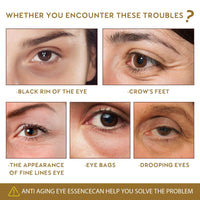 Rollerball Castor Oil,Castor Oil and Frankin-cense Eye Roller,Eye Cream for Dark Circles and Puffy Eyes,Eye Rollerball for Eyes,Eye Cream Anti Aging,Anti Wrinkle Eye Care Products,Eyebag Remover