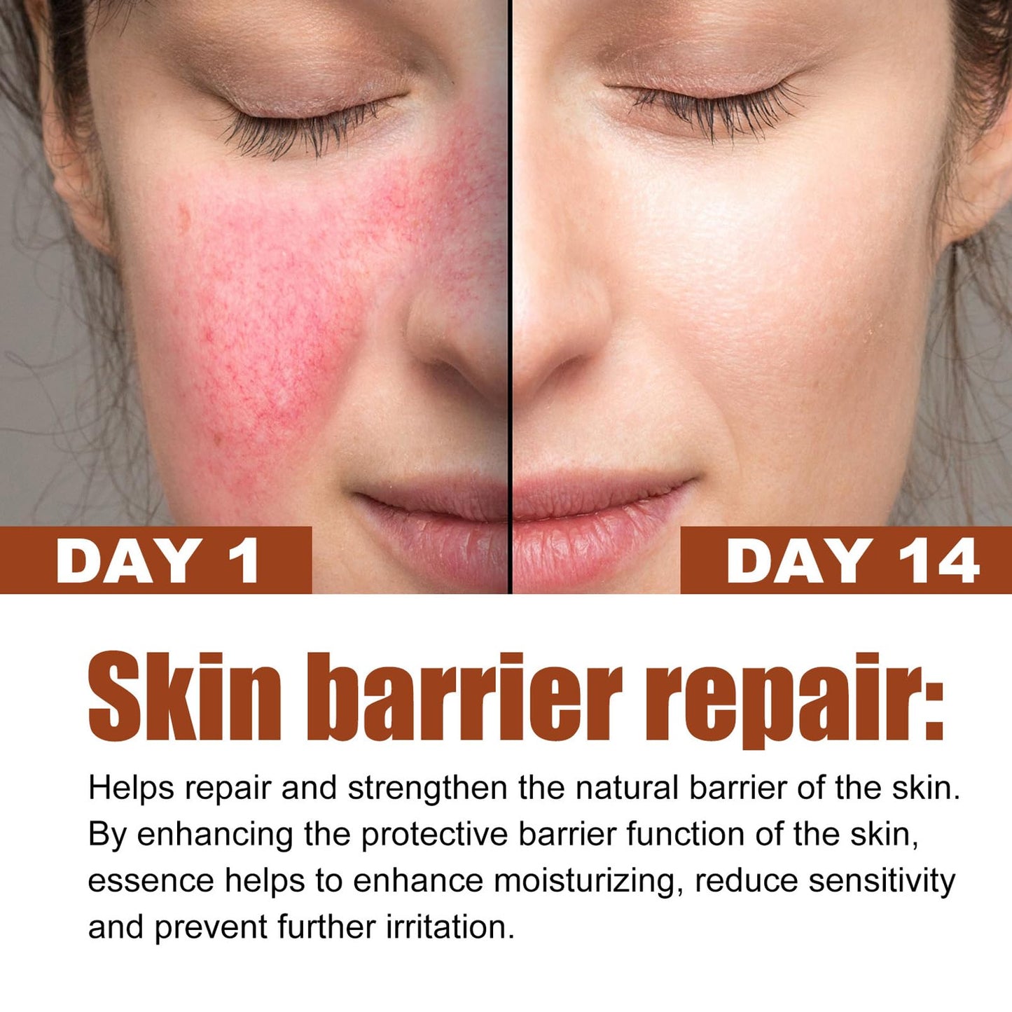 DMQ 2PCS Rosacea Face Serum,Anti Redness Face Serum,Tea Tree Anti Aging Serum for Face,Relieve Redness & Acne Mark,Natural Face Moisturizer for Sensitive Skin,Improve Skin Elasticity-Women & Men