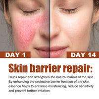 DMQ 2PCS Rosacea Face Serum,Anti Redness Face Serum,Tea Tree Anti Aging Serum for Face,Relieve Redness & Acne Mark,Natural Face Moisturizer for Sensitive Skin,Improve Skin Elasticity-Women & Men
