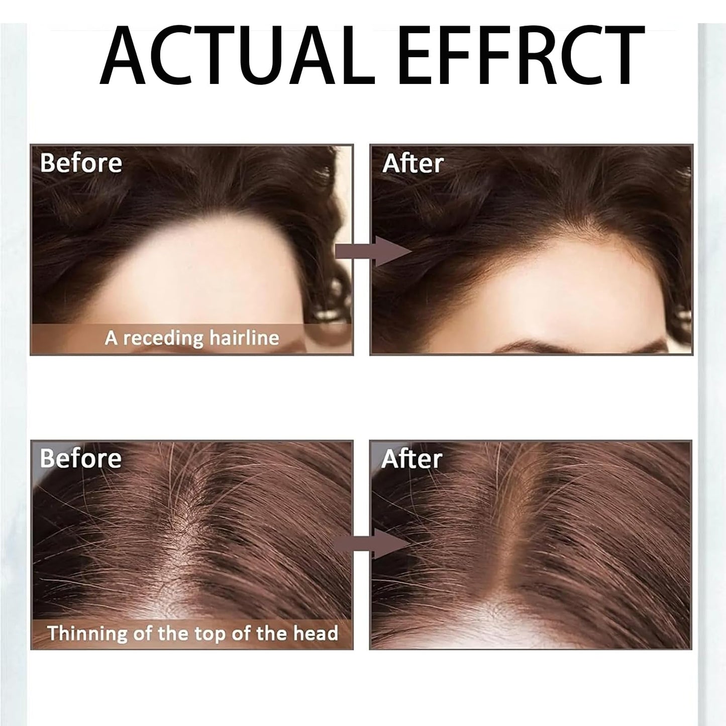 Shengqialun Root Cover Up Powder, Hairline Powder Dark Brown, Hair Root Colour Touch Up Instantly, Hair Roots Concealer Waterproof & Sweatproof, Grey Hair Cover Up For Women Men