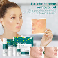 Skincare Set Gifts for Teenagers Girls - Tea Tree Skin Care Sets & Kits - Pamper Gifts for Women Includes Cleanser-Toner-Serum-Face Cream-Gel - Acne Remove Oil Control Facial Kit(5PCS)