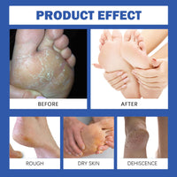 Mikloven 60% Urea Foot Cream for Cracked Heels & Dry Skin – Intensive Heel Repair for Feet and Hand, Deep Moisturizing Urea Cream 60 Percent for Feet & Body, Maximum Strength & Long-Lasting Hydration,200ml