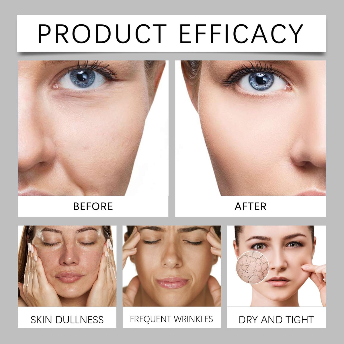 Xinyig 70ml Instant Firmx Temporary Tightener,Firming Cre/am for Loose S/kin,Instant Fa/ce Tightening Cr/eam,Sk/in Tightening Crea/m for F/ace,Anti Wrinkle Fac/e Cream for Mature Ski/n,Day and Night Cream