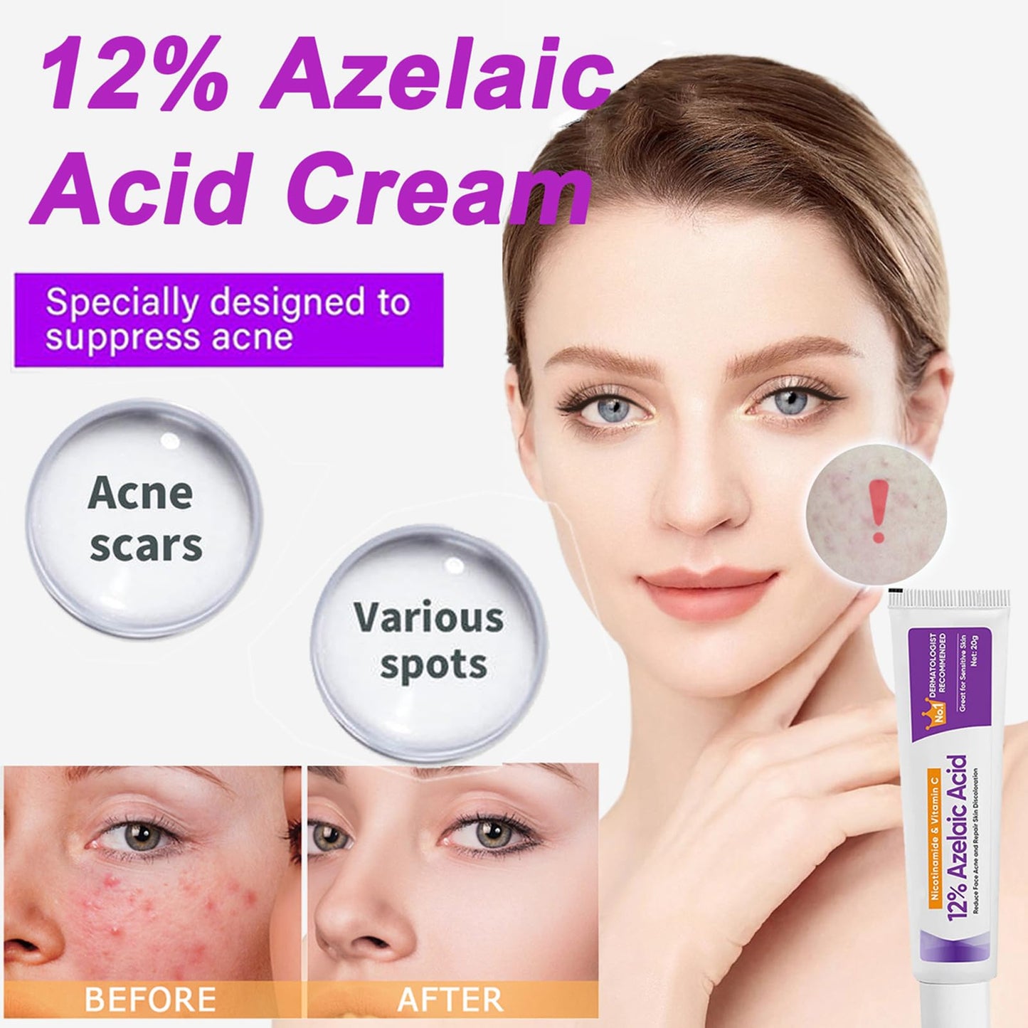 Night Cream Face Moisturiser, Azelaic Acid 12% Facial Serum Cream,Dark Spot Serum Cream for Face,Skincare with Niacinamide & Vitamin C,Beauty Products for Rosacea,Acne,Balance Excess Sebum
