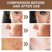 Glutathione Face Cream,Glutathione Anti-Aging Face Cream for Women & Men,Glutathione Hydrating & Whitening Cream,Dark Spot Remover for Face,Skin Brightener Cream,Face Moisturiser,Skin Care Moisturizer