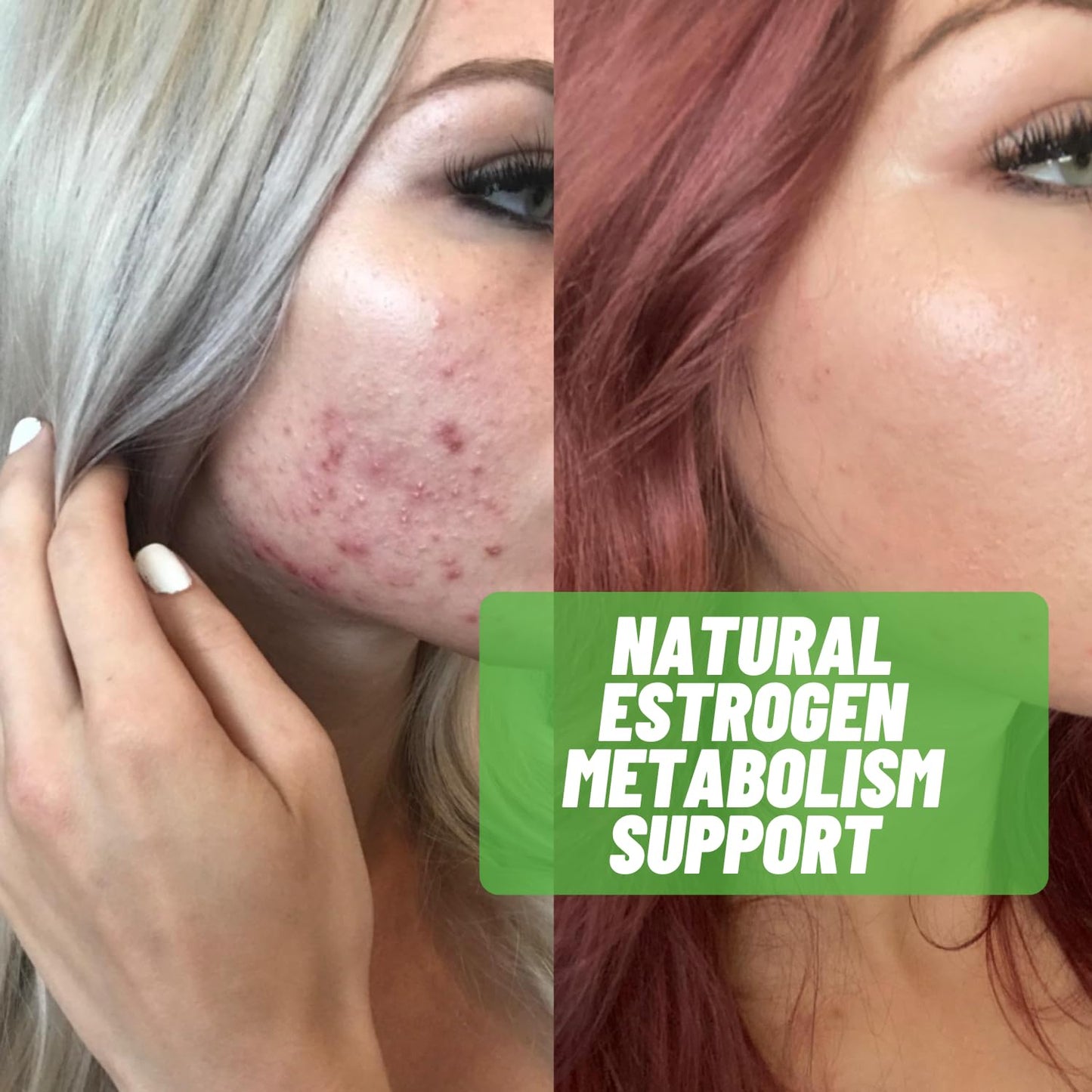 Addrena Estro-Halt 3 Pack - Advanced Estrogen Balance Support Formula | Natural Indole-3-Carbinol & Broccoli Extract for Healthy Estrogen Metabolism | Anti-Bloating Support for Men & Women -180 Capsules