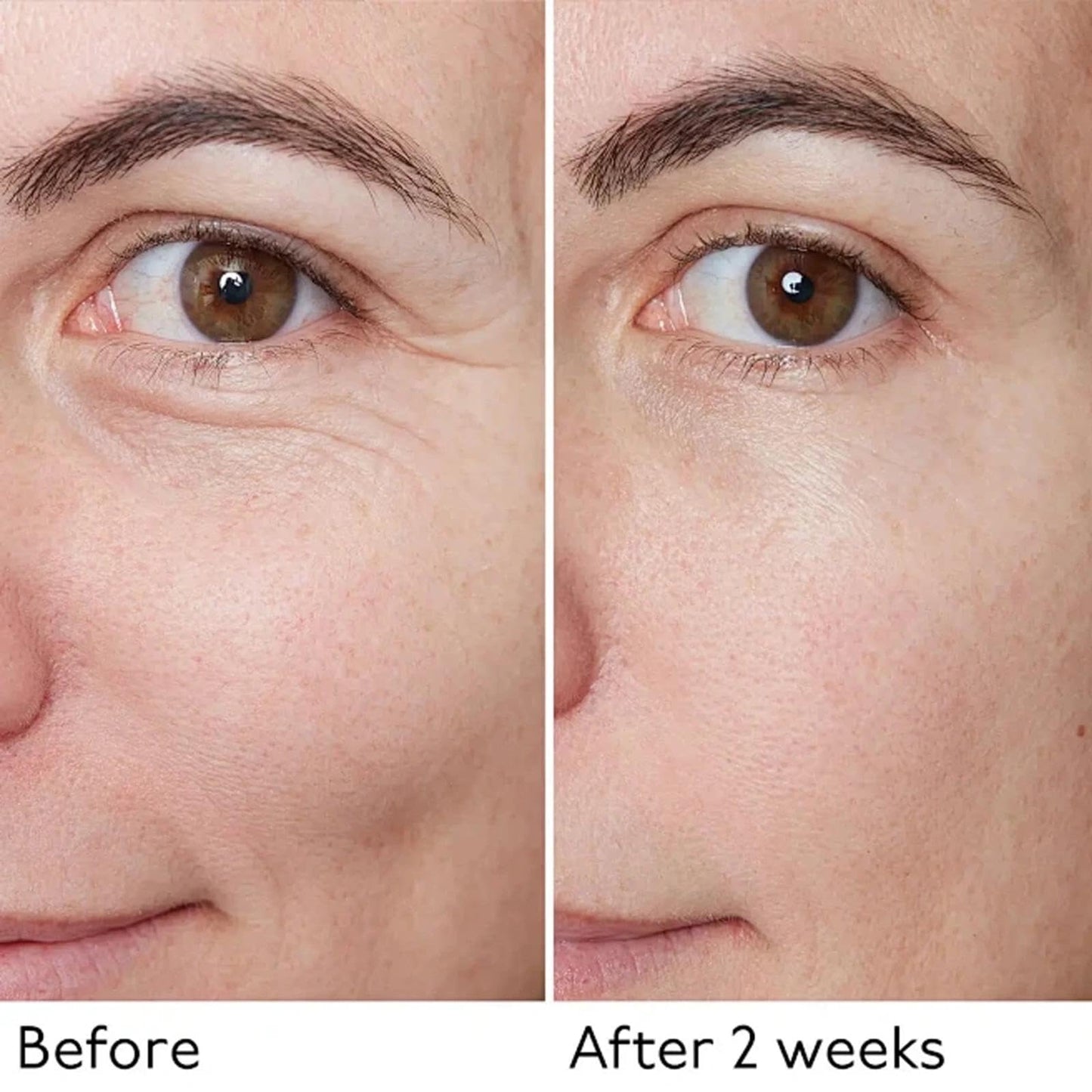 Lutein Eye Oil with Vitamin C – Dark Circle & Puffy Eye Treatment, Essential Lutein Rollerball Eye Cream, Perfect for Daily Use