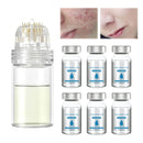Ninnyi 6 PCS Micro Infusion System for Lips, Beauty Micro Infusion Facial Kit