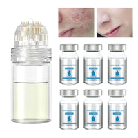 Ninnyi 6 PCS Micro Infusion System for Lips, Beauty Micro Infusion Facial Kit