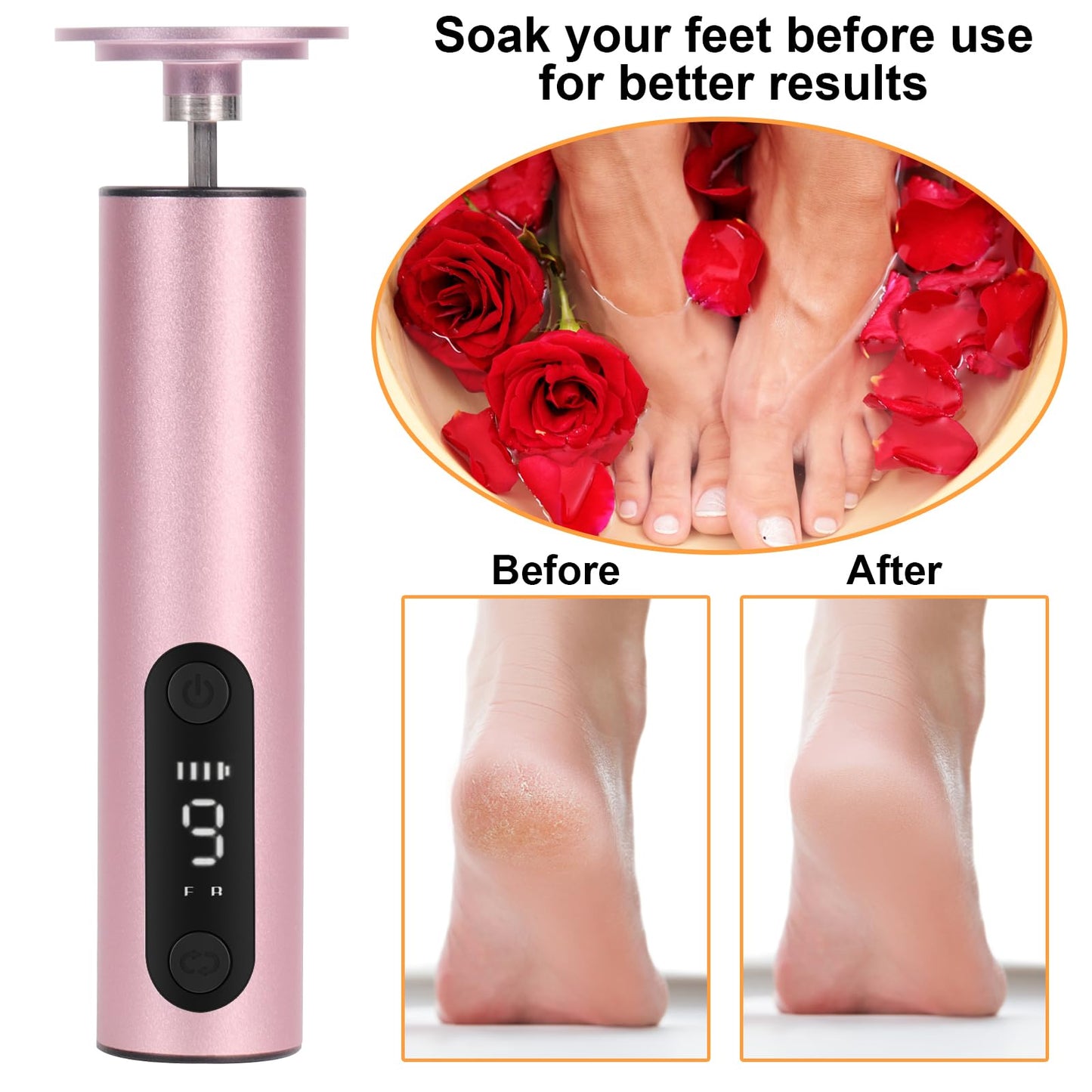 jianyana Jianyana 2 in 1 Electric Foot File, 9-Speed Pedicure Sets for Feet Electric Foot File with Digital Display Hard Skin Remover for Dry Dead Hard Skin Feet Callus Remover (Rose Gold)