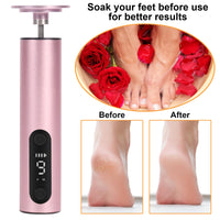 jianyana Jianyana 2 in 1 Electric Foot File, 9-Speed Pedicure Sets for Feet Electric Foot File with Digital Display Hard Skin Remover for Dry Dead Hard Skin Feet Callus Remover (Rose Gold)