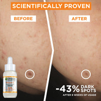 Garnier Naturals Vit C Anti-Dark Spot Serum 30Ml