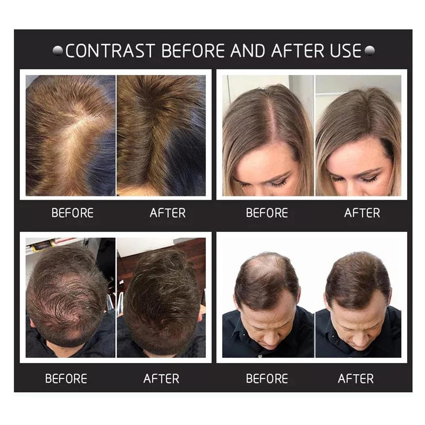 DMQ Hair Building Fibers,Natural Hair Fibers for Men & Women,Hair Fibres Dark Brown,Hair Powder for Thinning Hair,Easily Cover & Waterproof,Hair Loss Concealer,Instantly Conceals Hair Loss,Soft Powder