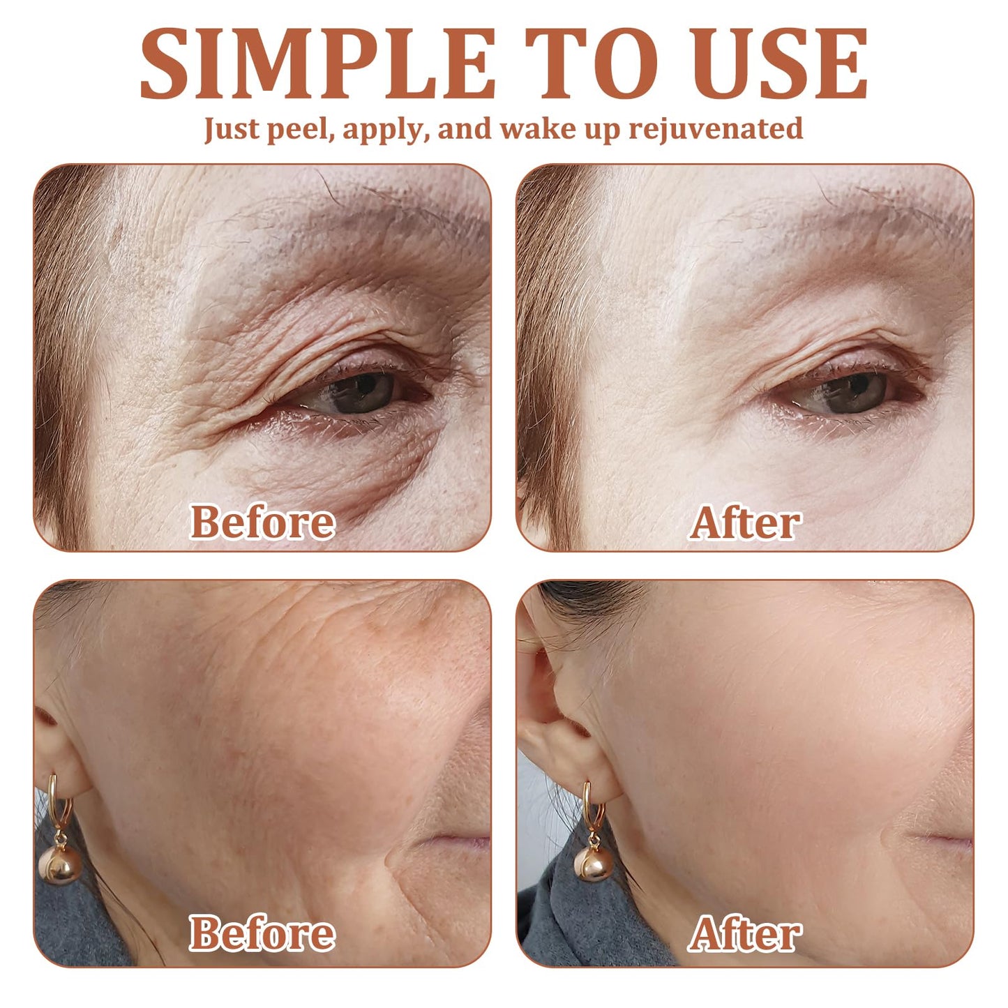ExcellaElite Wrinkle Patches 20 PCS