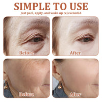 ExcellaElite Wrinkle Patches 20 PCS