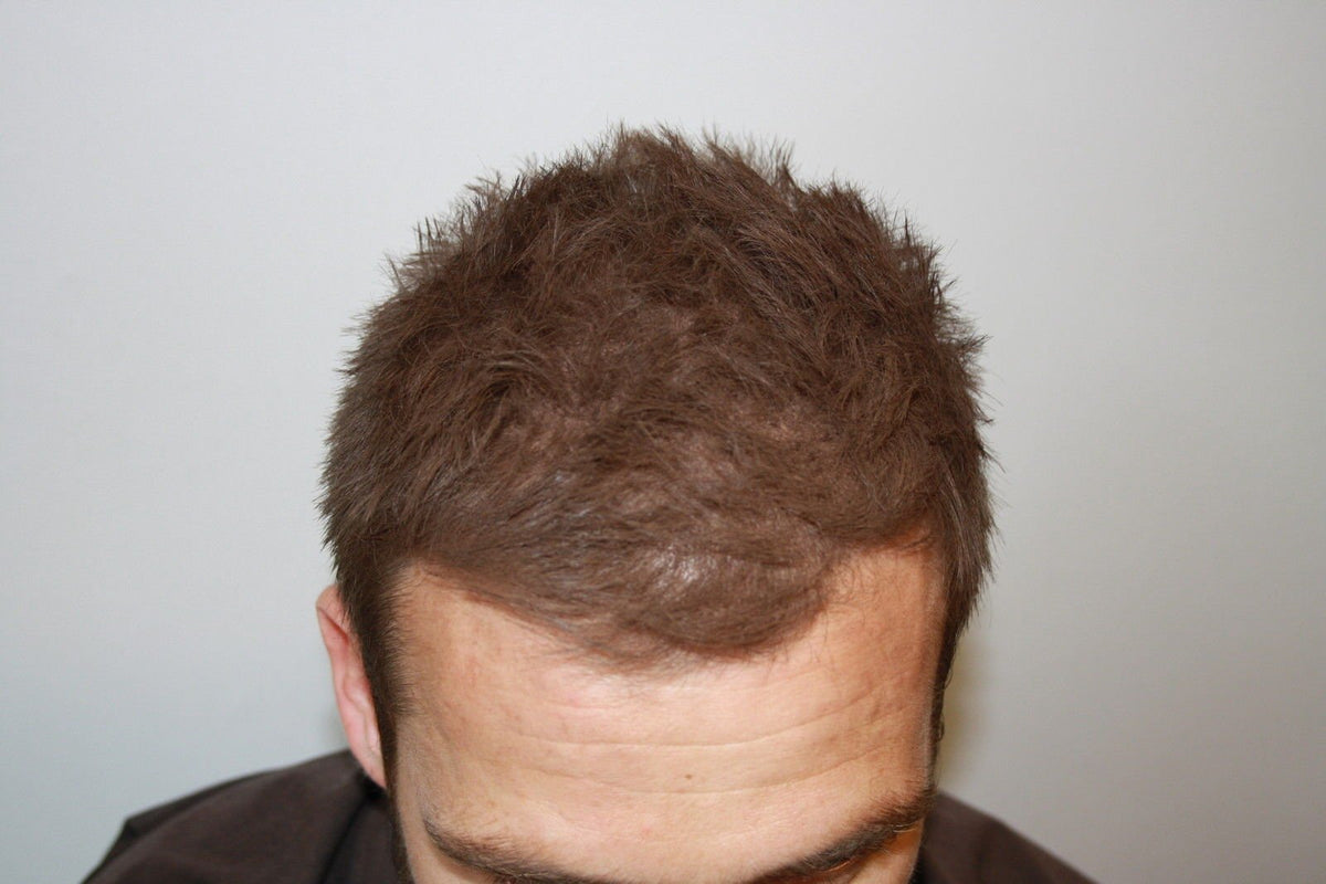 MANE Mane Hair Thickener Direct from the Manufacturer for hair loss and thinning hair Medium Brown