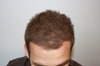 MANE Mane Hair Thickener Direct from the Manufacturer for hair loss and thinning hair Medium Brown