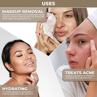 The Organic Forest – VEGAN . PURE . NATURAL 100% Pure Cold Pressed Unrefined Organic Jojoba Oil | Skin Care & Makeup Remover | Moisturizing Body Oil for Dry & Wrinkle Skin | USDA Certified Cleansing Oil, Hair Oil, Lip Oil & Massage Oil |